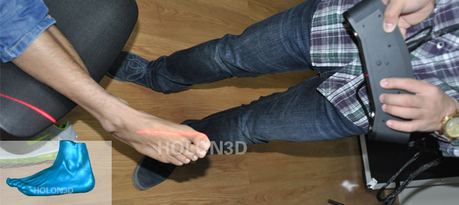 脚型三维扫描