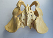 Hip bone three-dimensional detection、Three-dimensional detection inside the human body