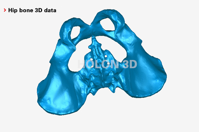 Hip bone 3D data