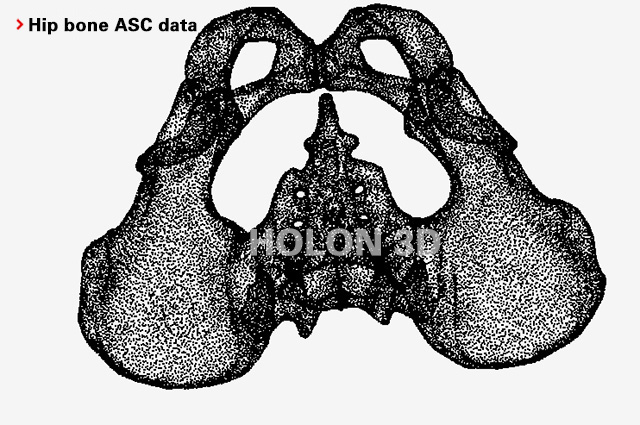 Hip bone ASC data