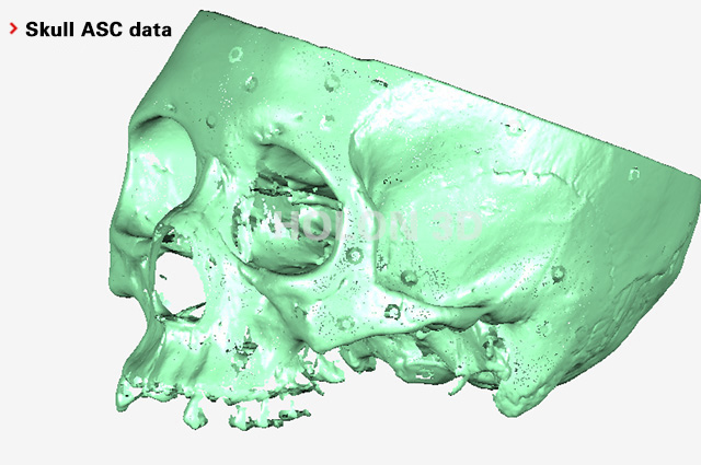 Skull ASC data