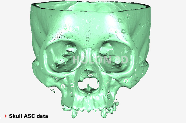 Skull ASC data