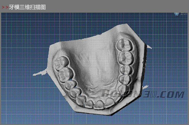 牙模三维扫描案例