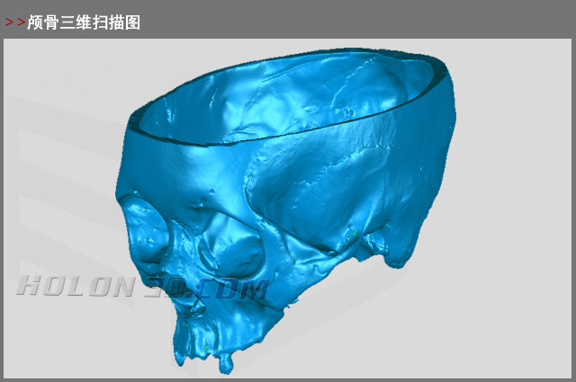 颅骨三维扫描图